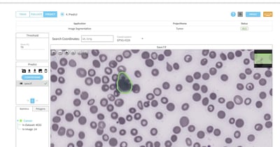 Advanced Imaging and AI in Leukemia Diagnosis: Enhancing Accuracy and Care