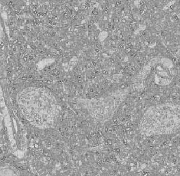 micrograph of a neural tissue