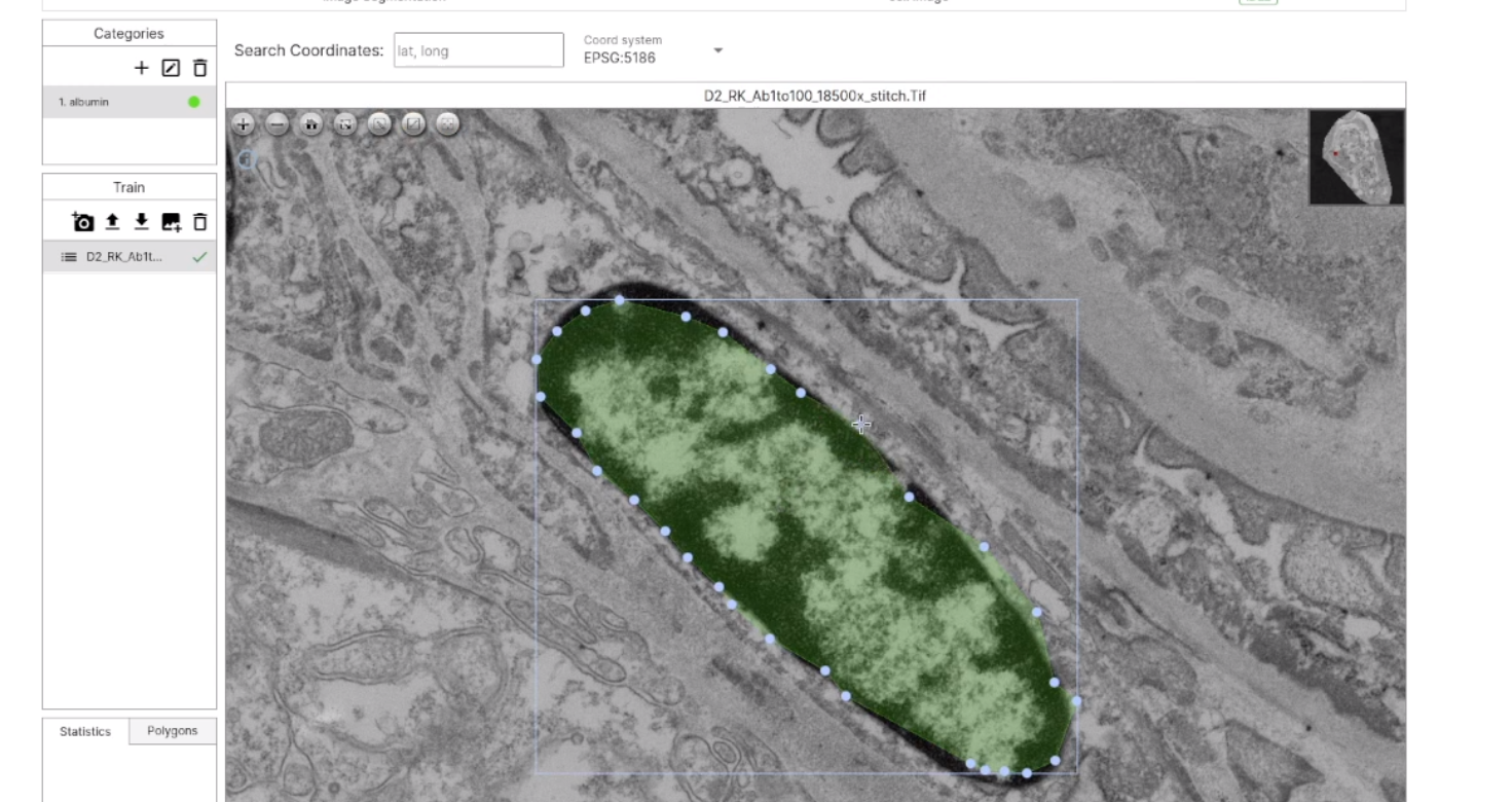 To build training data to find areas where albumin is present in TEM images, we used Deep Block.